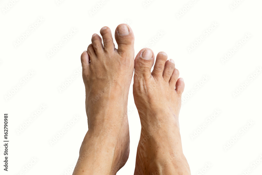 Foot of old women