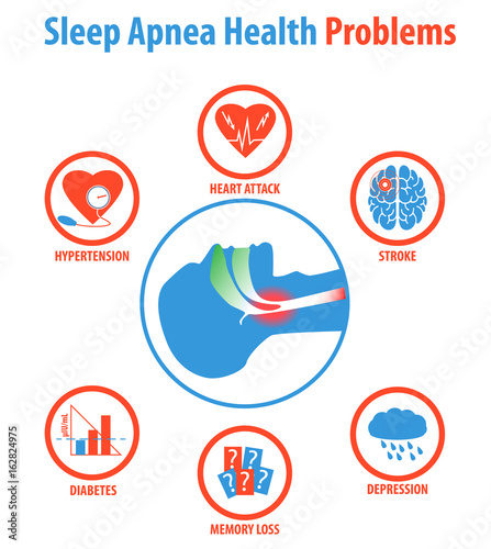 Sleep apnea: treatments, causes, symptoms and health problems.