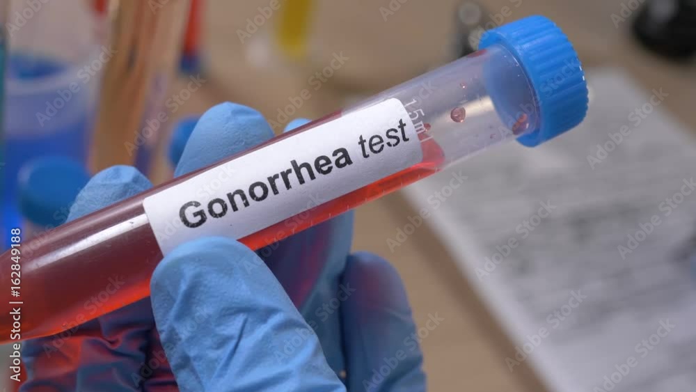 Scientist holding a Gonorrhea test tube while taking some notes observations in a notebook. Filmed in a lab environment. Closeup on the tube. Scientist holding a Gonorrhea test tube while taking some notes observations in a notebook. Filmed in a lab environment. Closeup on the tube.