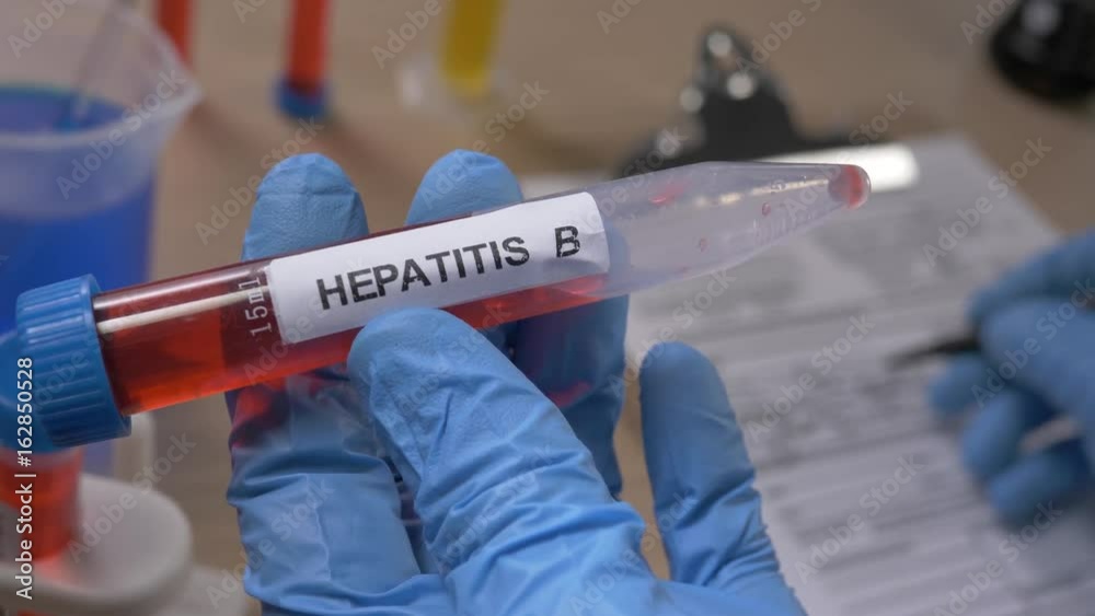 Scientist holding a Hepatitis B test tube while taking some notes observations in a notebook. Filmed in a lab environment. Closeup on the tube.