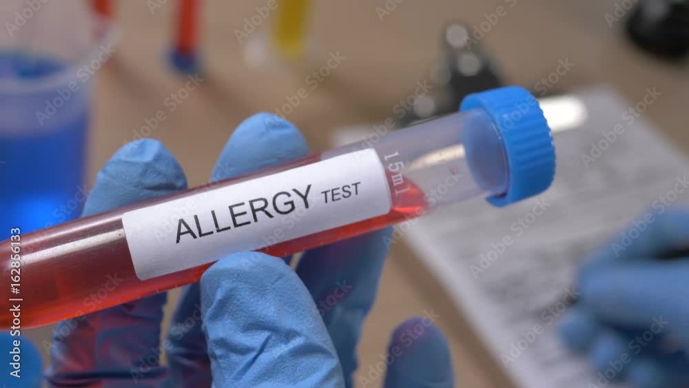 Scientist holding an Allergy test tube while taking some notes observations in a notebook. Filmed in a lab environment. Closeup on the tube. Scientist holding an Allergy test tube while taking some notes observations in a notebook. Filmed in a lab environment. Closeup on the tube.