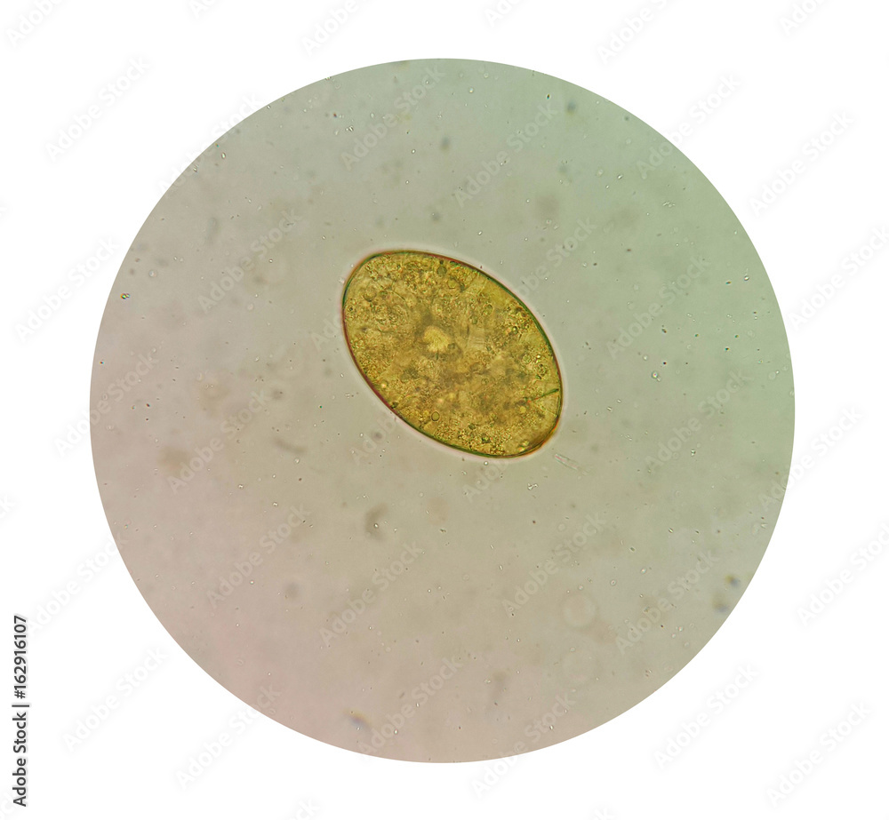 Stool parasites examination test for parasites or eggs in a human stool