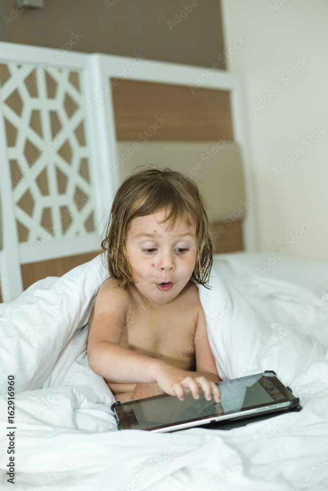 The child is sick with chickenpox. A European-looking girl, 4-5 years old, sits on a bed and holds a tablet. She is sick and her face is covered with pimples. The kid is having fun. The child is sick with chickenpox. A European-looking girl, 4-5 years old, sits on a bed and holds a tablet. She is sick and her face is covered with pimples. The kid is having fun.