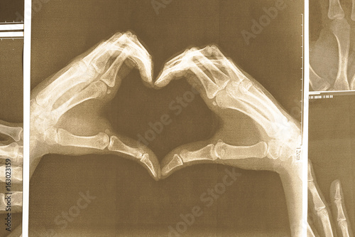 X-ray image of hands making heart symbols. photo