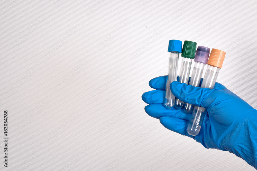 blood collection tube blood collection tube