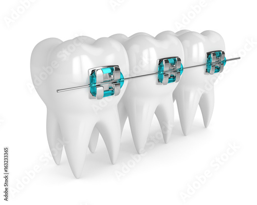 3d render of teeth with braces photo