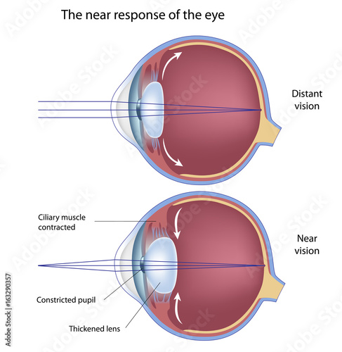 Φωτογραφία The near response of the eye
