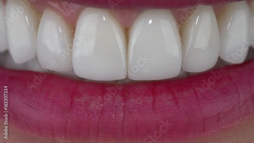 Slow motion close up: The young girl bites a kiwi. Minimally invasive porcelain veneers/ smile/ porcelain veneers color bleach