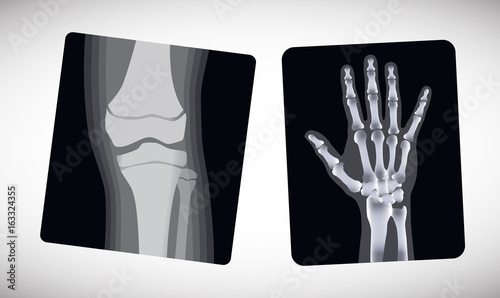 X-ray of the hand and foot. Vector