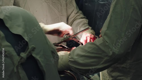 Operation. Heart surgery. Surgery.