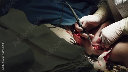 Operation. Heart surgery. Surgery.