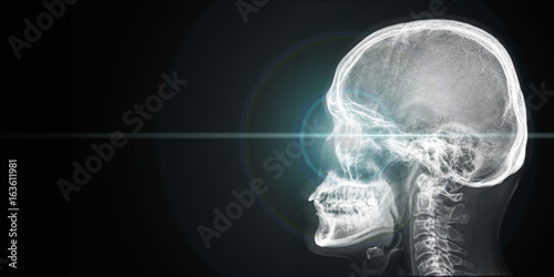x ray of human head with light from eye