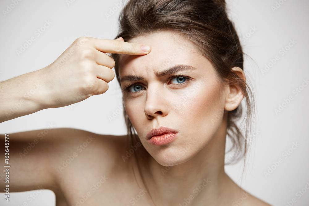 Young brunette girl displeased of her problem acne face skin over white background. Health cosmetology and skincare. Young brunette girl displeased of her problem acne face skin over white background. Health cosmetology and skincare.