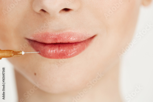 Close up of medical botox injection in lips over white background. Facial treatment.