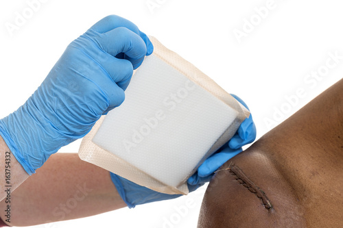 Tableau sur toile sticking-plaster was applied to awound sitched scar