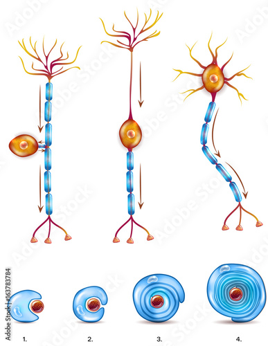 Nerve cell types and myelin sheath formation stages. A schwann cell envelops and rotates around the axon forming myelin sheath, now axon is myelinated. Close-up detailed anatomy illustration