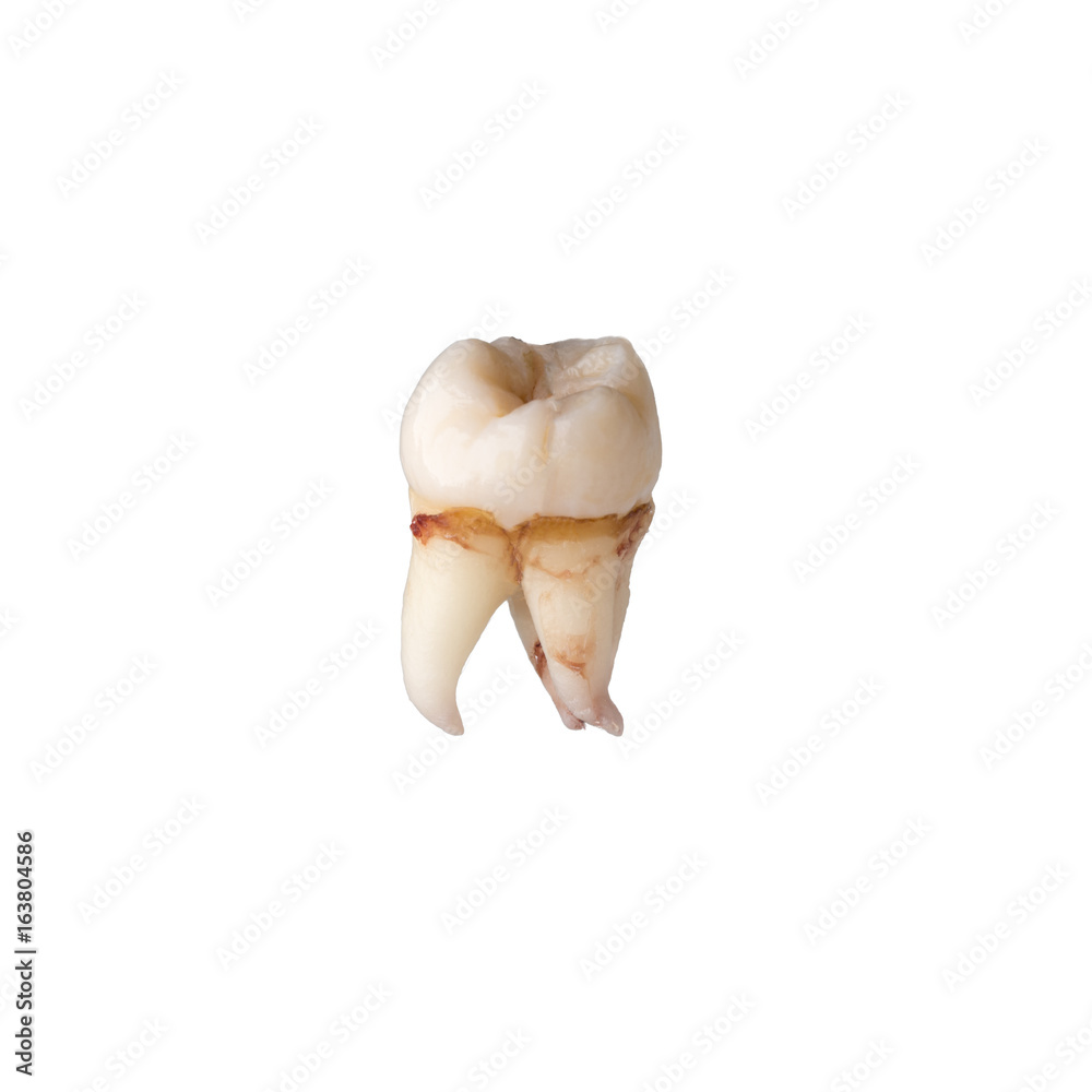 Fototapeta premium Extracted wisdom tooth, molar tooth