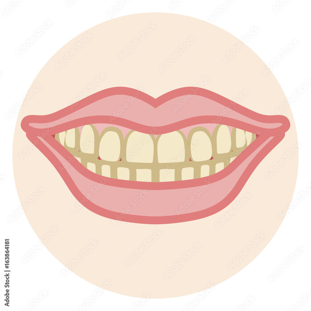 Dentition - Stain