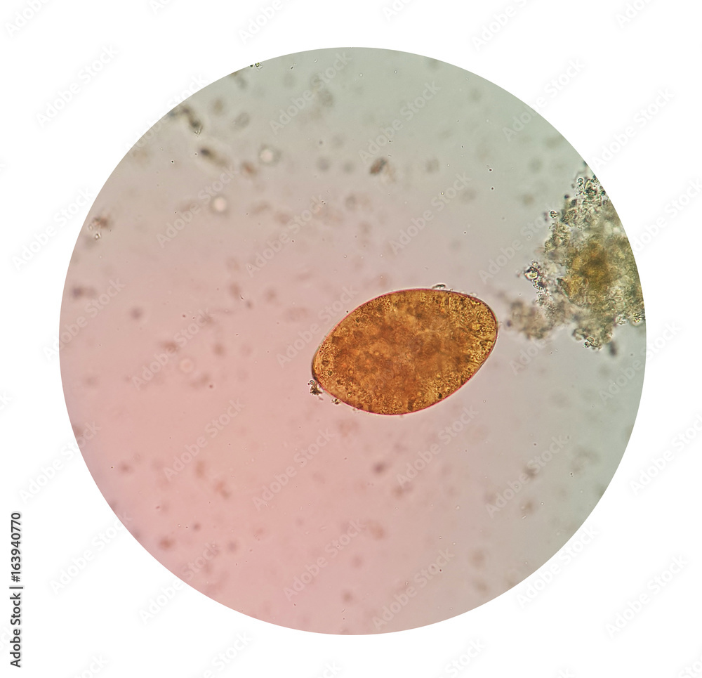 Stool parasites examination test for parasites or eggs in human stool