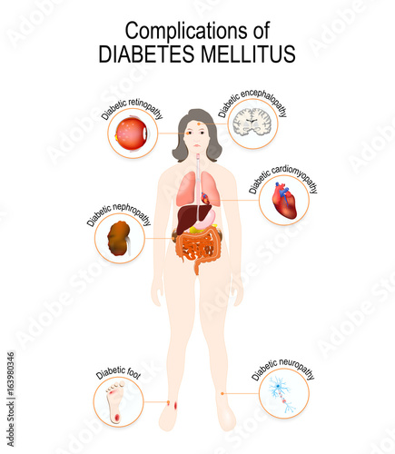 Complications of diabetes mellitus