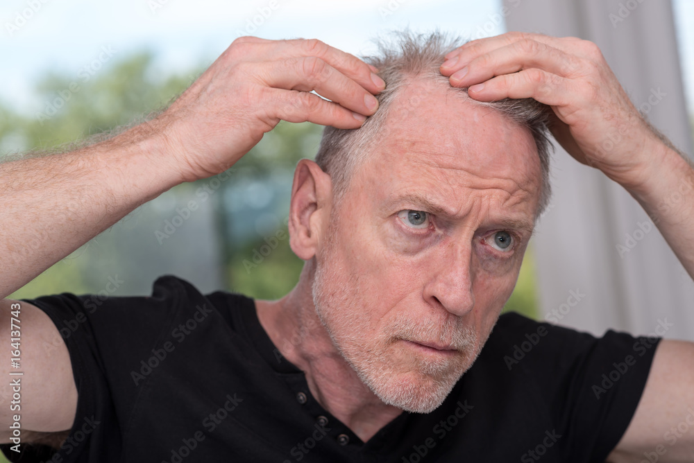 Senior man with hair concern Senior man with hair concern