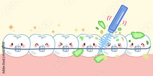 tooth wear brace with brush
