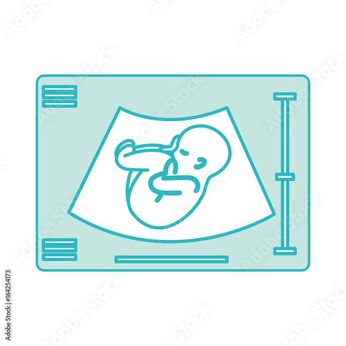 Ultrasound monitor isolated icon vector illustration design