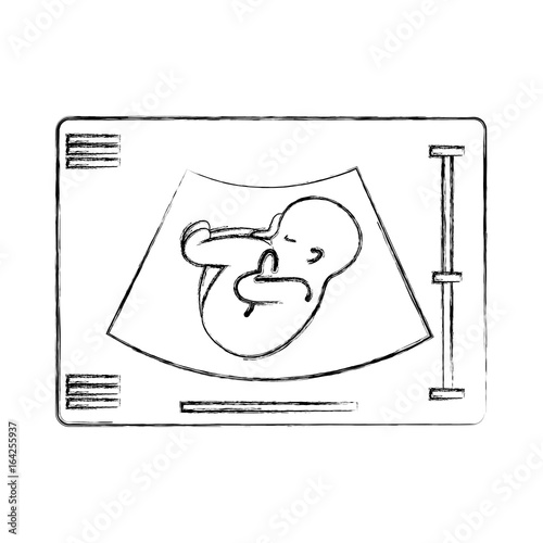Ultrasound monitor isolated icon vector illustration design