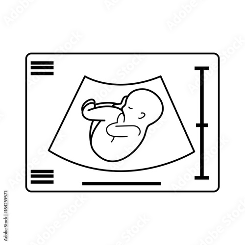 Ultrasound monitor isolated icon vector illustration design
