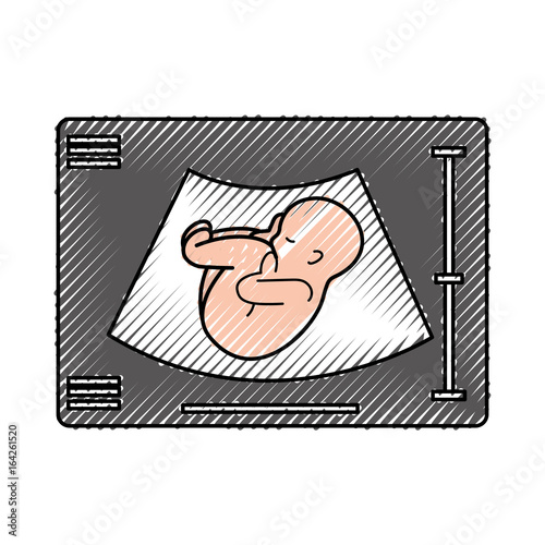 Ultrasound monitor isolated icon vector illustration design