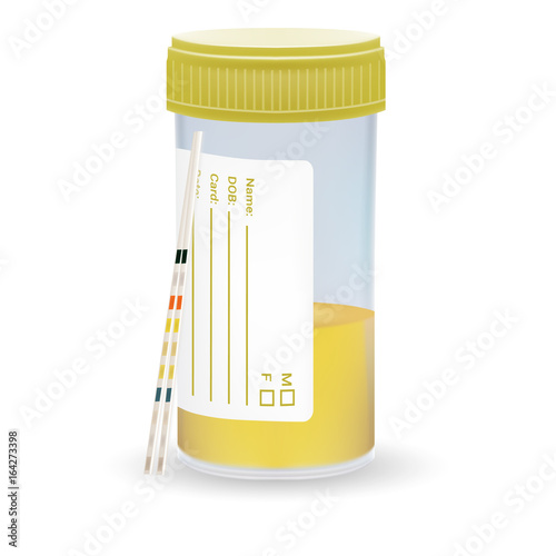 Ph Test Strips, Litmus Paper And Urine In Test Jar Isolated On A White Background. Realistic Vector Illustration.