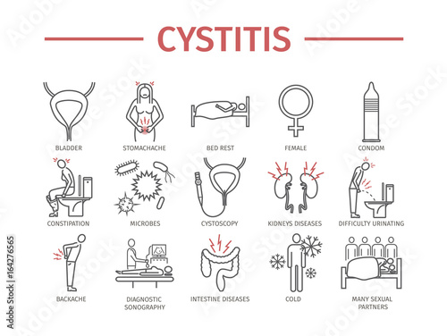 Cystitis. Symptoms, Treatment.