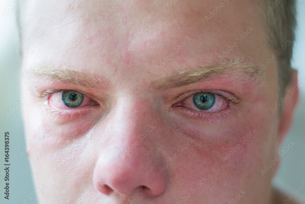 Face of crying adult man with blue eyes Face of crying adult man with blue eyes