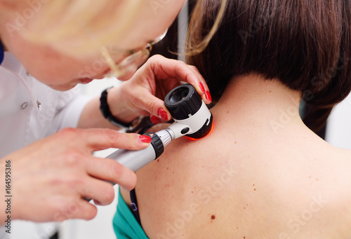 The dermatologist examines the moles or acne of the patient with a dermatoscope. Prevention of melanoma