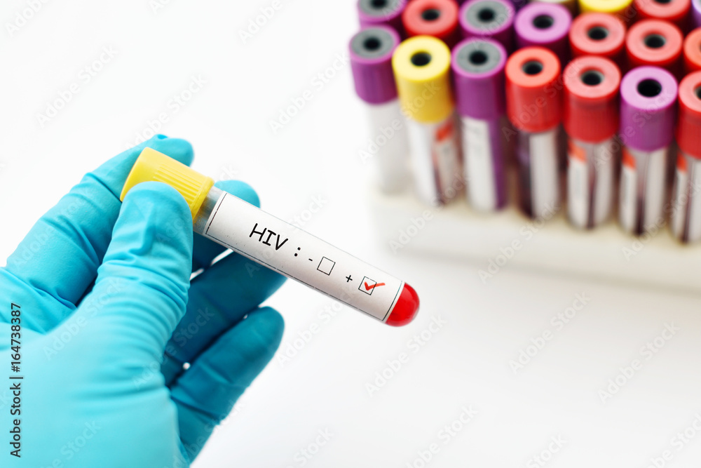 Obraz premium HIV positive