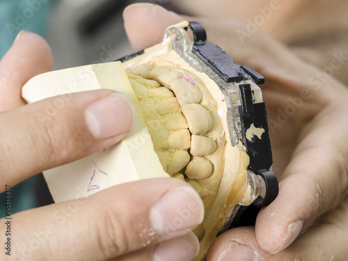 Closeup of dental technician applying ceramic to teeth, implant before putting into the furnace photo