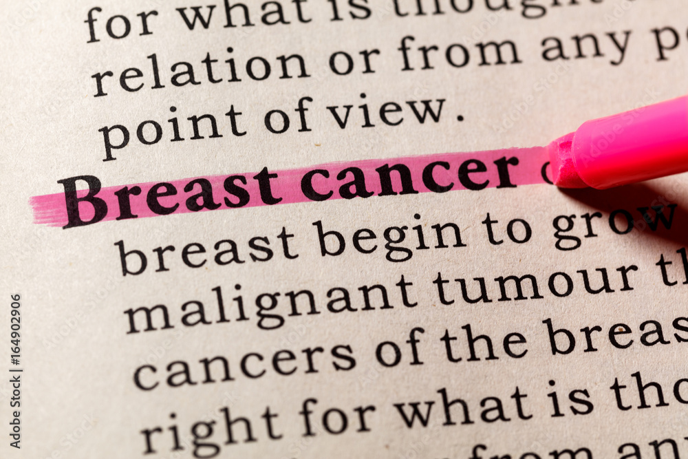 definition of breast cancer Stock Photo