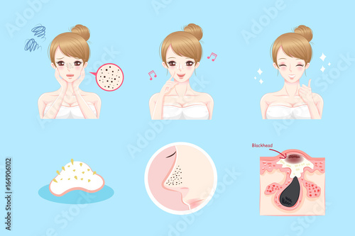 woman with acne problem