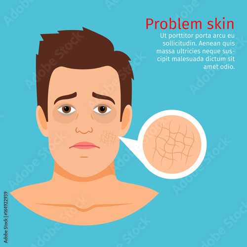 Young man face dry skin problem