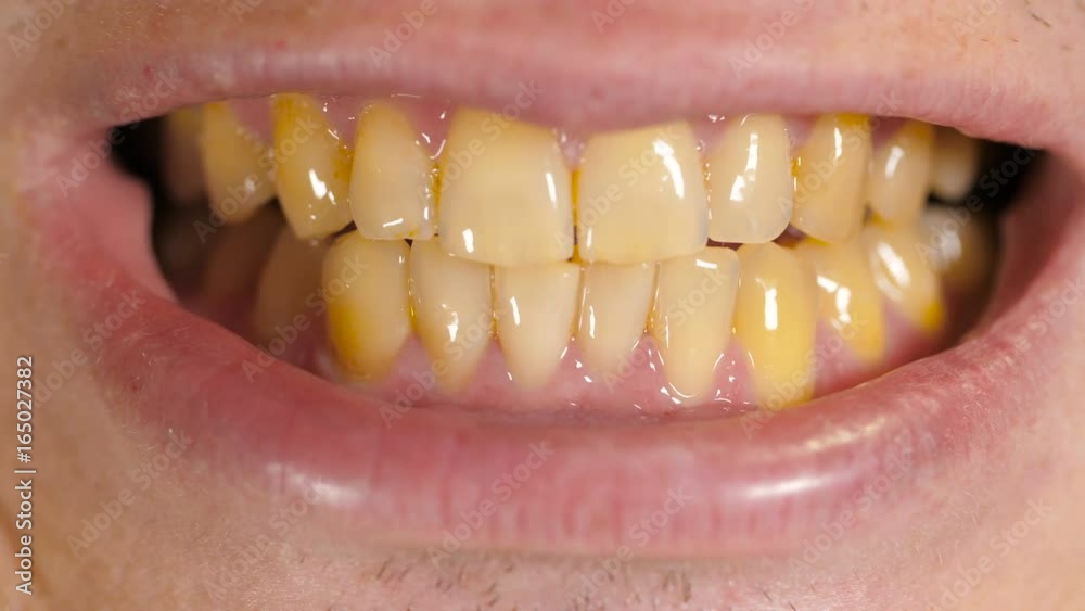 Yellow teeth of a man