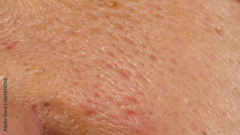 Problem Skin of a Man Problem Skin of a Man