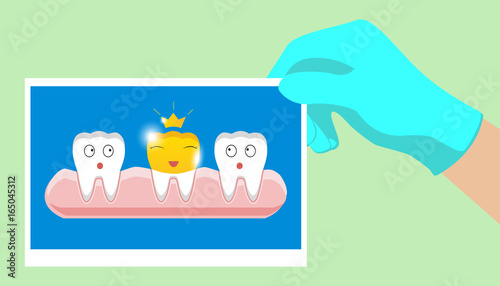 Tooth with golden dental crown icon in cartoon style on a white background