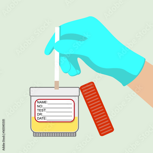 Acetone test. Medical express test. Ketones. Diagnostic test