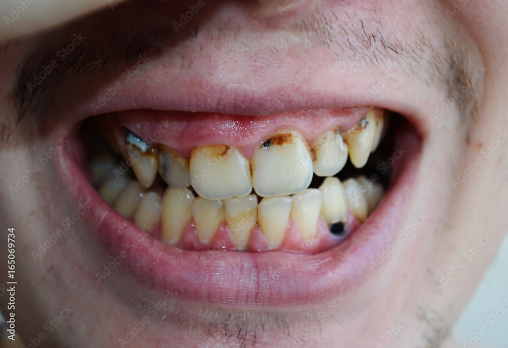 How To Win Buyers And Influence Sales with top dental implants in Dwarka