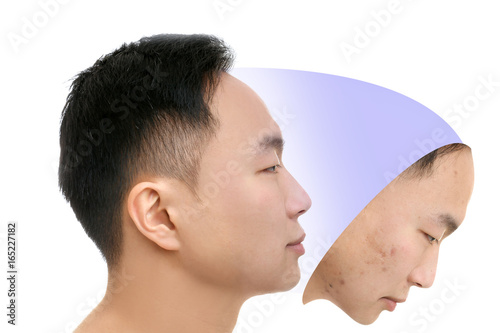 Young Asian man with proble...