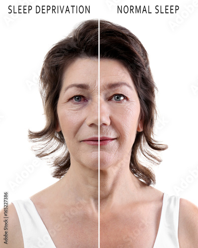 Фототапет Mature woman before and after exhaustion caused by sleep deprivation on white ba