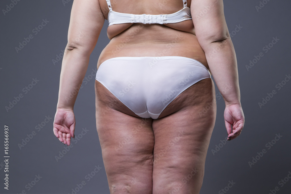 Overweight woman with fat legs and buttocks, obesity female body Stock-Foto  | Adobe Stock