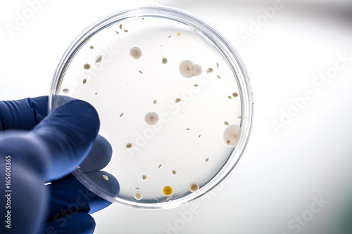 Vászonkép Scientist holding bacteria culture on agar