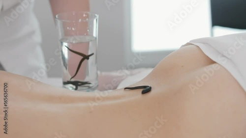 Doctor in clinic puts on leech on skin of woman, close up view photo