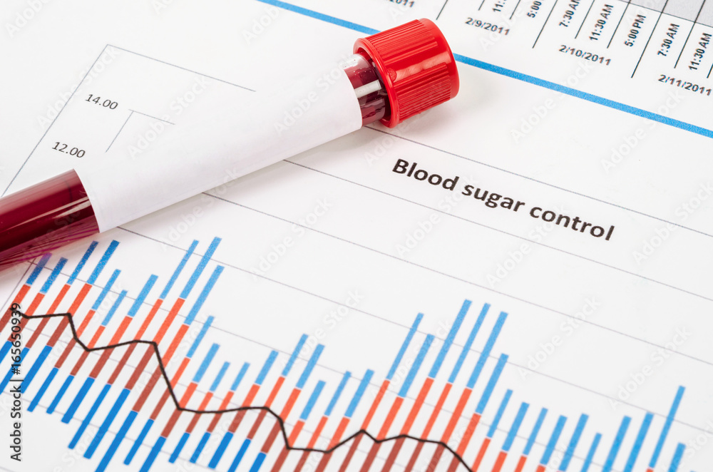 Sample blood for screening diabetic test in blood tube. Sample blood for screening diabetic test in blood tube.